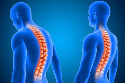 Влияет ли растяжка на улучшение осанки у мужчин. Сутулость во взрослом возрасте: как выпрямить круглую спину