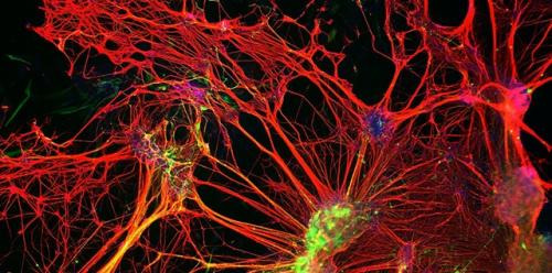 Тренировка завершена: что не стоит есть после занятий в спортзале 03 Тренировка завершена: что не стоит есть после занятий в спортзале 03