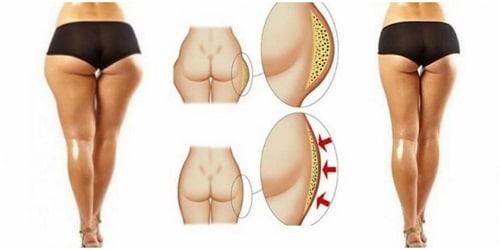 Какие упражнения помогают четко отделить ягодицы от задней части бедер. Упражнение, что бы четко отделить ягодицы от задней части бедер