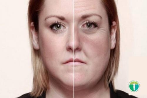 Как влияет употребление алкоголя на кожу лица. Как алкоголь влияет на кожу лица?